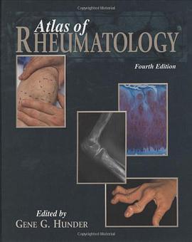 Atlas of Rheumatology pdf epub mobi 电子书 下载