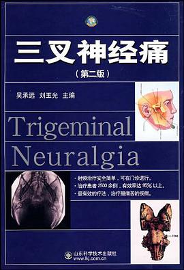 三叉神经痛 pdf epub mobi 电子书 下载