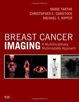 Breast Cancer Imaging pdf epub mobi 电子书 下载