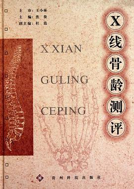 X线骨龄测评