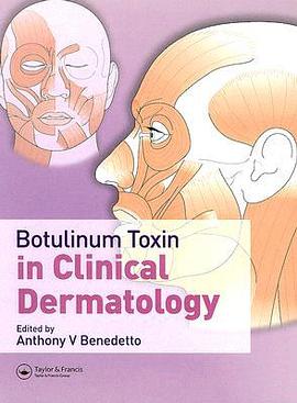 BOTULINUM TOXIN IN CLINICAL DERMATOLOGY pdf epub mobi 电子书 下载