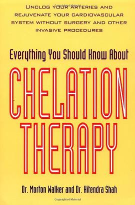 Everything You Should Know About Chelation Therapy pdf epub mobi 电子书 下载