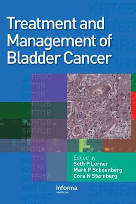 Treatment and Management of Bladder Cancer pdf epub mobi 電子書 下載