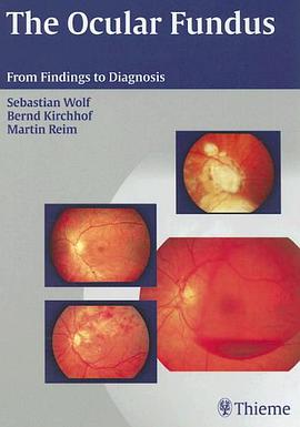 The Ocular Fundus pdf epub mobi 电子书 下载