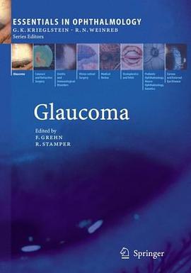 Glaucoma pdf epub mobi 下载