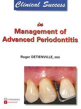 Clinical Success in Management of Advanced Periodontitis pdf epub mobi 电子书 下载
