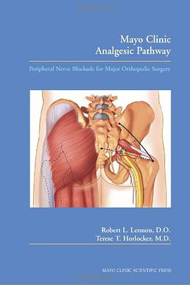 Mayo Clinic Analgesic Pathway pdf epub mobi 电子书 下载