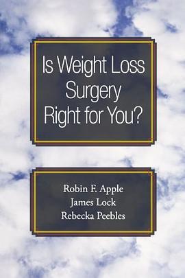 Is Weight Loss Surgery Right for You? pdf epub mobi 電子書 下載