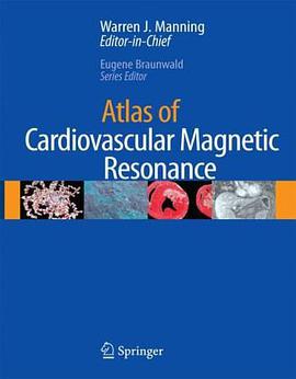 Atlas of Cardiovascular Magnetic Resonance Imaging pdf epub mobi 电子书 下载