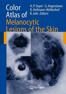 Color Atlas of Melanocytic Lesions of the Skin pdf epub mobi 电子书 下载