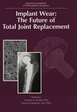 Implant Wear pdf epub mobi 电子书 下载