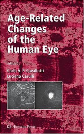 Age-Related Changes of the Human Eye pdf epub mobi 电子书 下载