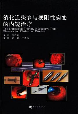 消化道狭窄与梗阻性病变的内镜治疗
