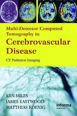 Multidetector Computed Tomography in Cerebrovascular Disease pdf epub mobi 电子书 下载