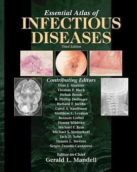 Essential Atlas of Infectious Diseases pdf epub mobi 电子书 下载