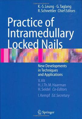 Practice of Intramedullary Locked Nails pdf epub mobi 电子书 下载