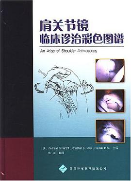 肩关节镜临床诊治彩色图谱 pdf epub mobi 电子书 下载