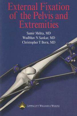 External Fixation of the Pelvis and Extremities pdf epub mobi 电子书 下载