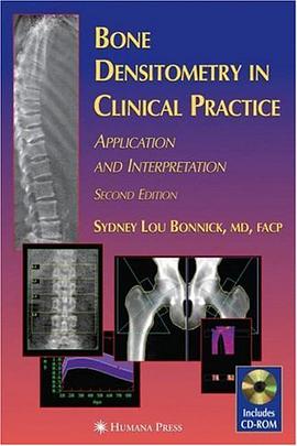 Bone Densitometry in Clinical Practice pdf epub mobi 电子书 下载