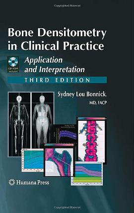 Bone Densitometry in Clinical Practice pdf epub mobi 电子书 下载