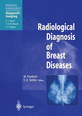 Radiological Diagnosis of Breast Diseases pdf epub mobi 电子书 下载