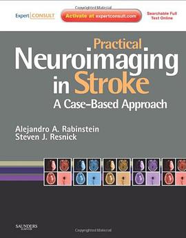 Practical Neuroimaging in Stroke pdf epub mobi 电子书 下载