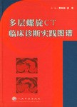 多层螺旋CT临床诊断实践图谱