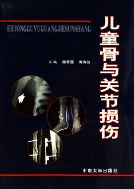 兒童骨與關節損傷 pdf epub mobi 電子書 下載