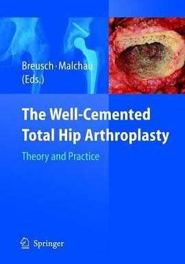 The Well-Cemented Total Hip Arthroplasty pdf epub mobi 电子书 下载
