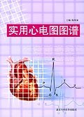 实用心电图图谱 pdf epub mobi 电子书 下载