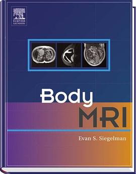 Body MRI pdf epub mobi 电子书 下载