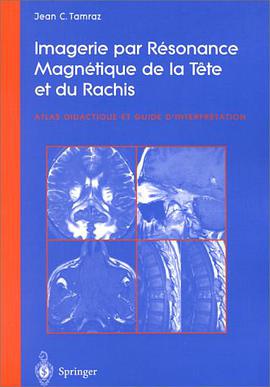 Imagerie Par Resonance Magnetique de La Tete Et Du Rachis pdf epub mobi 电子书 下载