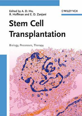 Stem Cell Transplantation pdf epub mobi 电子书 下载