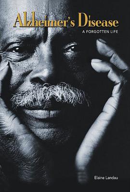 Alzheimer's Disease pdf epub mobi 下载