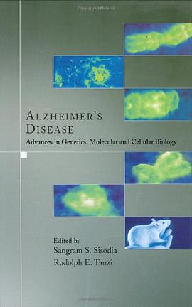 Alzheimer's Disease pdf epub mobi 电子书 下载