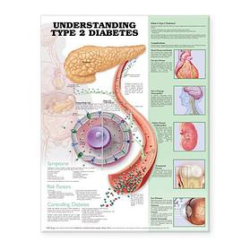 Understanding Type 2 Diabetes Anatomical Chart pdf epub mobi 电子书 下载