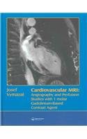 Cardiovascular MRI pdf epub mobi 电子书 下载