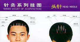 针灸系列挂图 pdf epub mobi 电子书 下载