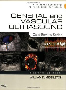 General and Vascular Ultrasound pdf epub mobi 电子书 下载