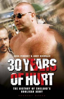 30 YEARS OF HURT pdf epub mobi 电子书 下载