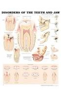 Disorders of the Teeth and Jaw Anatomical Chart pdf epub mobi 电子书 下载