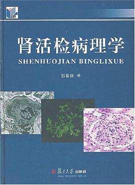 肾活检病理学 pdf epub mobi 电子书 下载