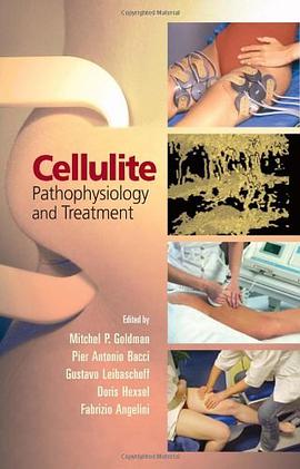 Cellulite Pathophysiology pdf epub mobi 电子书 下载