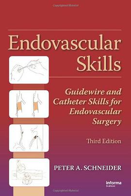 Endovascular Skills pdf epub mobi 电子书 下载