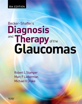Becker-Shaffer's Diagnosis and Therapy of the Glaucomas, 8e