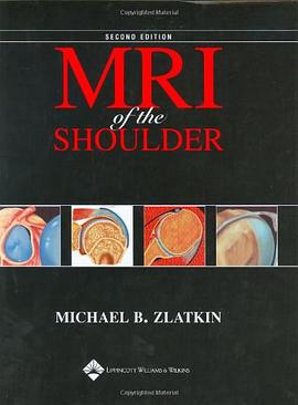 MRI of the Shoulder pdf epub mobi 电子书 下载