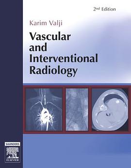 Vascular and Interventional Radiology pdf epub mobi 电子书 下载