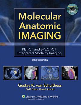 Molecular Anatomic Imaging pdf epub mobi 电子书 下载