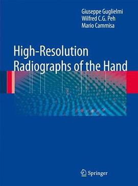 High-Resolution Radiographs of the Hand pdf epub mobi 电子书 下载