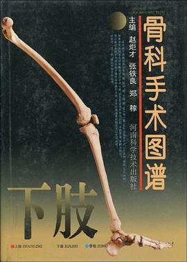 骨科手术图谱（下肢） pdf epub mobi 电子书 下载